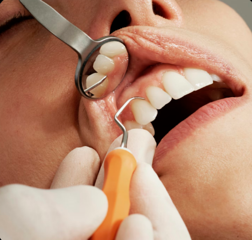 Rehabilitación Oral